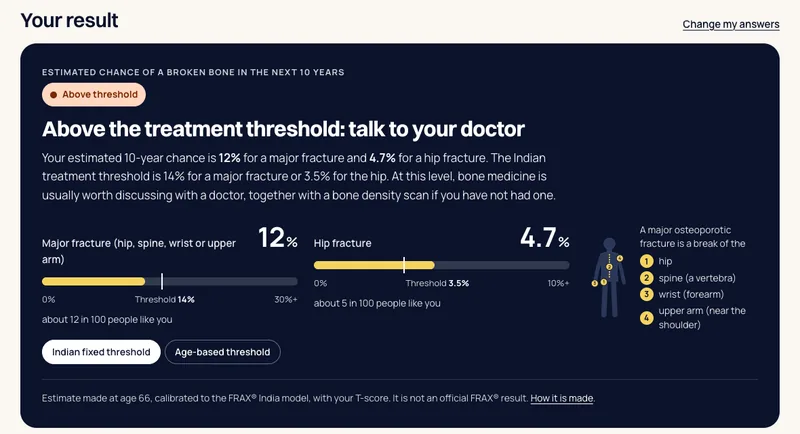 Screenshot of the osteoporosis and fracture risk calculator result: a 12 percent major fracture and 4.7 percent hip fracture estimate against Indian thresholds